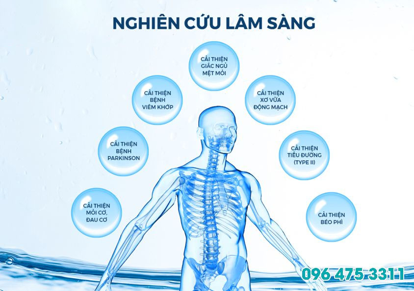 Máy lọc nước kiềm Trim Ion Grace