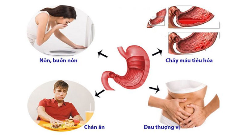 Nước điện giải ion kiềm và bệnh viêm loét dạ dày