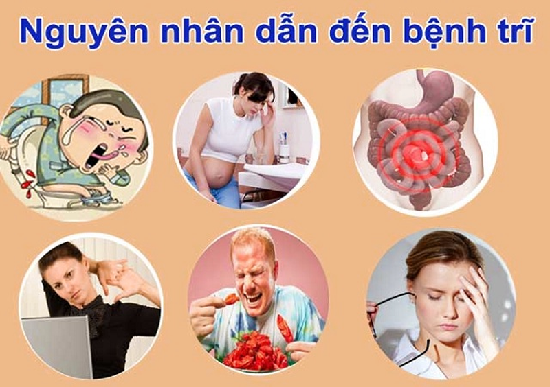 Nước điện giải ion kiềm và bệnh trĩ